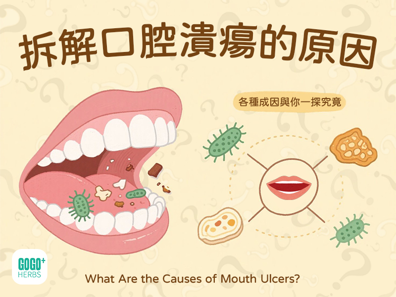 拆解口腔潰瘍的原因