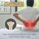 男人骨質疏鬆的表現