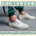穿錯鞋子竟會加劇痛風？