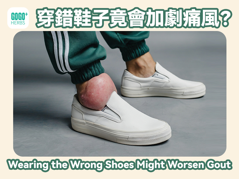穿錯鞋子竟會加劇痛風？