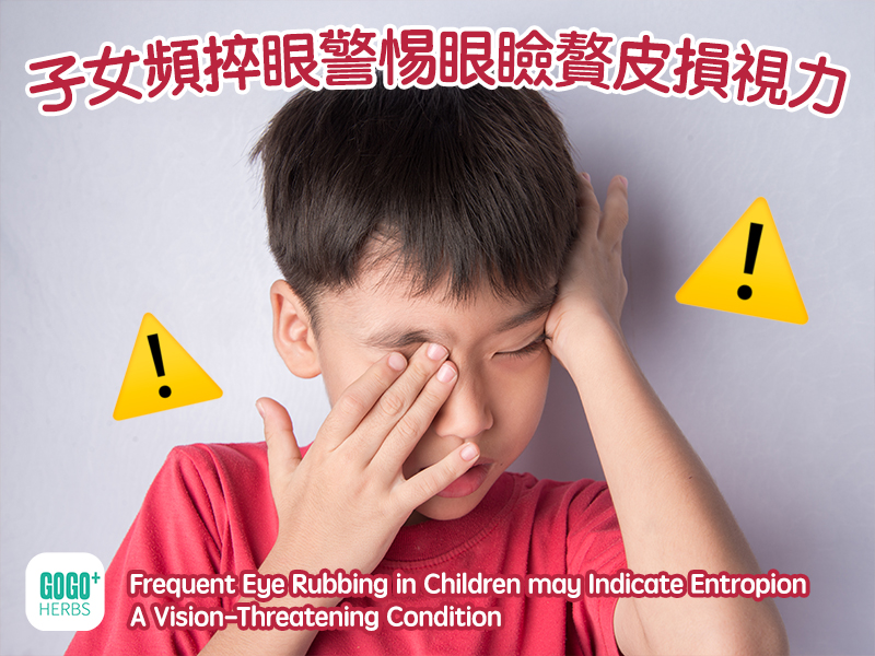 Frequent Eye Rubbing in Children may Indicate Entropion – A Vision-Threatening Condition
