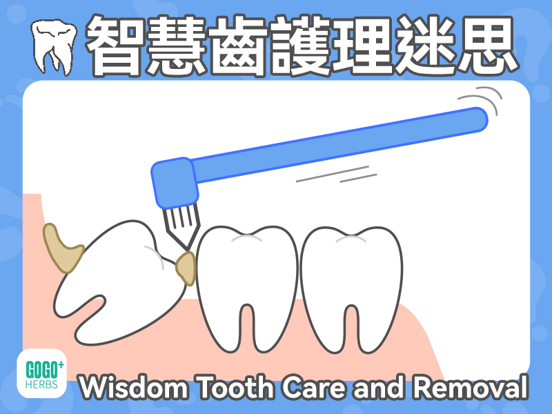 Wisdom Tooth Care and Removal