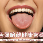 Your Tongue can Reveils About Your Health