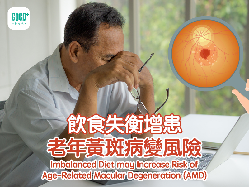 Imbalanced Diet may Increase Risk of Age-Related Macular Degeneration (AMD)
